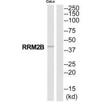 Western blot analysis of extracts from COLO205 cells, using RRM2B antibody.