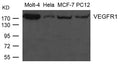 Western blot analysis of extract from Molt-4, Hela, MCF-7 and PC12 cells using VEGFR1 Antibody