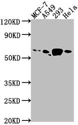 Western Blot
Positive WB detected in: MCF-7 whole cell lysate, A549 whole cell lysate, 293 whole cell lysate, Hela whole cell lysate
All lanes: PDE1B antibody at 1:1000
Secondary
Goat polyclonal to rabbit IgG at 1/50000 dilution
Predicted band size: 62, 60 kDa
Observed band size: 62 kDa