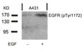 Western blot analysis of extracts from A431 cells untreated or treated with EGF using EGFR(Phospho-Tyr1172) Antibody.