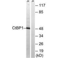 Western blot analysis of extracts from Jurkat cells, using CtBP1 (Ab-422) antibody.