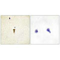 Immunohistochemistry analysis of paraffin-embedded human brain tissue, using ICK antibody.