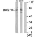 Western blot analysis of extracts from Jurkat cells and COLO205 cells, using DUSP16 antibody.