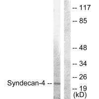 Western blot analysis of extracts from HepG2 cells, using Syndecan4 (Ab-179) antibody.