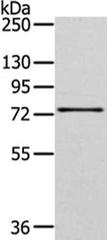 Gel: 6%SDS-PAGE, Lysate: 40 ug, Lane: PC cell, Primary antibody: CSB-PA278805(GHR Antibody) at dilution 1/400 dilution, Secondary antibody: Goat anti rabbit IgG at 1/8000 dilution, Exposure time: 2 minutes