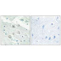 Immunohistochemistry analysis of paraffin-embedded human brain tissue, using JAK1 antibody.