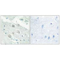 Immunohistochemistry analysis of paraffin-embedded human brain tissue, using JAK1 antibody.