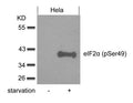 Western blot analysis of extracts from Hela cells untreated or treated with starvation using eIF2a(phospho-Ser49) Antibody.