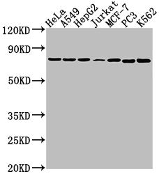 Western Blot
Positive WB detected in: Hela whole cell lysate, A549 whole cell lysate, HepG2 whole cell lysate, Jurkat whole cell lysate, MCF-7 whole cell lysate, PC3 whole cell lysate, K562 whole cell lysate
All lanes: HSPA1B antibody at 1:2000
Secondary
Goat polyclonal to rabbit IgG at 1/50000 dilution
Predicted band size: 71 kDa
Observed band size: 71 kDa