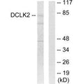 Western blot analysis of extracts from HepG2 cells, using DCLK2 antibody.