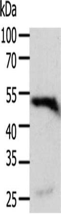 Gel: 10%SDS-PAGE, Lysate: 40 ug, Lane: NIH/3T3 cells, Primary antibody: CSB-PA281000(RELA Antibody) at dilution 1/300, Secondary antibody: Goat anti rabbit IgG at 1/8000 dilution, Exposure time: 30 minutes