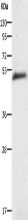 Gel: 10%SDS-PAGE, Lysate: 40 ug, Lane: Human liver cancer tissue, Primary antibody: CSB-PA281661(AGT Antibody) at dilution 1/200, Secondary antibody: Goat anti rabbit IgG at 1/8000 dilution, Exposure time: 5 minutes