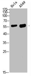 Western blot analysis of HELA A549 Cell Lysate, antibody was diluted at 1:1000. Secondary antibody  was diluted at 1:20000