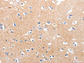 The image on the left is immunohistochemistry of paraffin-embedded Human brain tissue using CSB-PA282702(MAPK8 Antibody) at dilution 1/30, on the right is treated with synthetic peptide. (Original magnification: ×200)