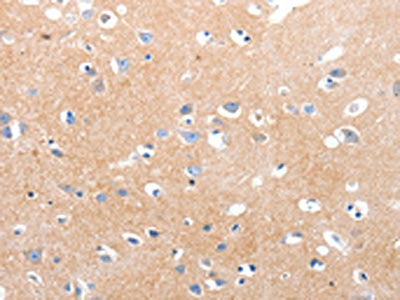 The image on the left is immunohistochemistry of paraffin-embedded Human brain tissue using CSB-PA282702(MAPK8 Antibody) at dilution 1/30, on the right is treated with synthetic peptide. (Original magnification: ×200)