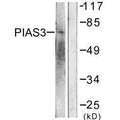 Western blot analysis of extracts from 293 cells, treated with UV (5mins), using PIAS3 antibody.