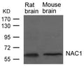 Western blot analysis of extracts from Rat and Mouse brain tissue  using NAC1 Antibody.