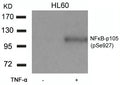 Western blot analysis of extracts from HL60 cells untreated or treated with TNF-a using NFkB-p105(Phospho-Ser927) Antibody.