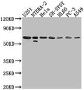 Western Blot
Positive WB detected in: U251 whole cell lysate, NTERA-2 whole cell lysate, Hela whole cell lysate, SH-SY5Y whole cell lysate, HL60 whole cell lysate, PC-3 whole cell lysate, A549 whole cell lysate
All lanes: CDK17 antibody at 1:2000
Secondary
Goat polyclonal to rabbit IgG at 1/50000 dilution
Predicted band size: 60 kDa
Observed band size: 60 kDa