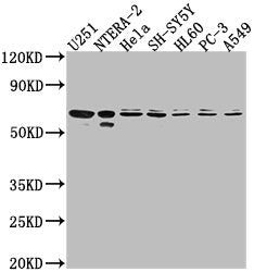 Western Blot
Positive WB detected in: U251 whole cell lysate, NTERA-2 whole cell lysate, Hela whole cell lysate, SH-SY5Y whole cell lysate, HL60 whole cell lysate, PC-3 whole cell lysate, A549 whole cell lysate
All lanes: CDK17 antibody at 1:2000
Secondary
Goat polyclonal to rabbit IgG at 1/50000 dilution
Predicted band size: 60 kDa
Observed band size: 60 kDa