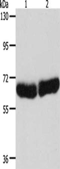 Gel: 8%SDS-PAGE, Lysate: 40 ug, Lane 1-2: Human fetal liver tissue, Human brain tissue, Primary antibody: CSB-PA283874(CYP1B1 Antibody) at dilution 1/250, Secondary antibody: Goat anti rabbit IgG at 1/8000 dilution, Exposure time: 30 seconds