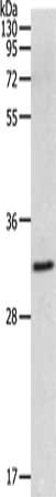 Gel: 10%SDS-PAGE, Lysate: 60 ug, Lane: 293T cells, Primary antibody: CSB-PA283929(MMP26 Antibody) at dilution 1/500, Secondary antibody: Goat anti rabbit IgG at 1/8000 dilution, Exposure time: 10 minutes