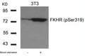 Western blot analysis of extracts from 3T3 cells untreated or treated with serum starvation using FKHR(Phospho-Ser319) Antibody.