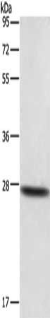 Gel: 10%SDS-PAGE, Lysate: 40 ug, Lane: Mouse lung tissue, Primary antibody: CSB-PA284301(DKK2 Antibody) at dilution 1/500, Secondary antibody: Goat anti rabbit IgG at 1/8000 dilution, Exposure time: 1 minute