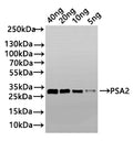 Western Blot
Positive WB detected in: recombinant protein
All lanes: PSA2 Antibody at 1:1000
Secondary
Goat polyclonal to rabbit IgG at 1/50000 dilution
Predicted band size: 24 kDa
Observed band size: 33 kDa