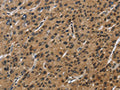 The image on the left is immunohistochemistry of paraffin-embedded Human liver cancer tissue using CSB-PA285442(SYN1 Antibody) at dilution 1/50, on the right is treated with synthetic peptide. (Original magnification: ×200)