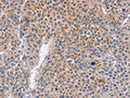PLK1 Antibody – Figure 1 of 1