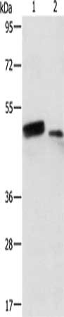 Gel: 8%SDS-PAGE, Lysate: 50 ug, Lane 1-2: Human liver cancer tissue, Human normal liver tissue, Primary antibody: CSB-PA286401(RARB Antibody) at dilution 1/500, Secondary antibody: Goat anti rabbit IgG at 1/8000 dilution, Exposure time: 2 minutes