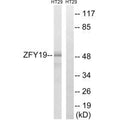 Western blot analysis of extracts from HT-29 cells, using ZFYVE19 antibody.