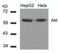 Western blot analysis of extracts from HepG2 and Hela cells using Akt(Ab-308) Antibody.