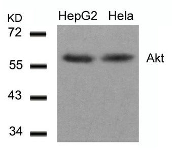 Western blot analysis of extracts from HepG2 and Hela cells using Akt(Ab-308) Antibody.