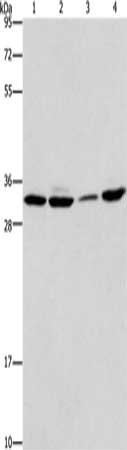 Gel: 10%SDS-PAGE, Lysate: 40 ug, Lane 1-4: 231 cells, A549 cells, hela cells, mouse brain tissue, Primary antibody: CSB-PA288653(BMI1 Antibody) at dilution 1/300, Secondary antibody: Goat anti rabbit IgG at 1/8000 dilution, Exposure time: 1 minute