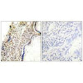 Immunohistochemical analysis of paraffin-embedded human placenta tissue using p14 ARF antibody.