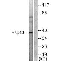 Western blot analysis of extracts from COLO205 cells, using HSP40 antibody.