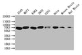 Western Blot
Positive WB detected in: A549 whole cell lysate, MCF7 whole cell lysate, K562 whole cell lysate, 293T whole cell lysate, U251 whole cell lysate, Hela whole cell lysate, Mouse Brain tissue lysate, Rat Brain tissue lysate
All lanes: BTRC antibody at 1:1000
Secondary
Goat polyclonal to rabbit IgG at 1/50000 dilution
Predicted band size: 69 kDa
Observed band size: 69 kDa