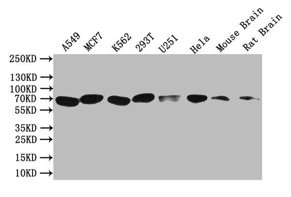Western Blot
Positive WB detected in: A549 whole cell lysate, MCF7 whole cell lysate, K562 whole cell lysate, 293T whole cell lysate, U251 whole cell lysate, Hela whole cell lysate, Mouse Brain tissue lysate, Rat Brain tissue lysate
All lanes: BTRC antibody at 1:1000
Secondary
Goat polyclonal to rabbit IgG at 1/50000 dilution
Predicted band size: 69 kDa
Observed band size: 69 kDa