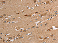 The image on the left is immunohistochemistry of paraffin-embedded Human brain tissue using CSB-PA289221(TLR8 Antibody) at dilution 1/30, on the right is treated with fusion protein. (Original magnification: ×200)