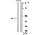 Western blot analysis of extracts from HUVEC cells, using ZNF75 antibody.