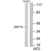Western blot analysis of extracts from HUVEC cells, using ZNF75 antibody.