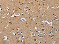 The image on the left is immunohistochemistry of paraffin-embedded Human brain tissue using CSB-PA290015(GNB5 Antibody) at dilution 1/20, on the right is treated with fusion protein. (Original magnification: ×200)
