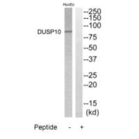 Western blot analysis of extracts from HuvEC cells, using DGKB antibody.