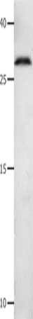 Gel: 12%SDS-PAGE, Lysate: 30 ug, Lane: 231 cells, Primary antibody: CSB-PA291582(MMP7 Antibody) at dilution 1/600, Secondary antibody: Goat anti rabbit IgG at 1/8000 dilution, Exposure time: 2 minutes