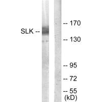 Western blot analysis of extracts from COLO205 cells, using SLK antibody.