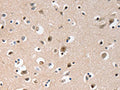 The image on the left is immunohistochemistry of paraffin-embedded Human brain tissue using CSB-PA291790(GCG(GLP1) Antibody) at dilution 1/20, on the right is treated with synthetic peptide. (Original magnification: ×200)