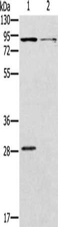 Gel: 8%SDS-PAGE, Lysate: 40 ug, Lane 1-2: Mouse kidney tissue, Mouse brain tissue, Primary antibody: CSB-PA292433(CNGA3 Antibody) at dilution 1/500, Secondary antibody: Goat anti rabbit IgG at 1/8000 dilution, Exposure time: 2 minutes