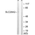 Western blot analysis of extracts from Jurkat cells, using SLC28A2 antibody.
